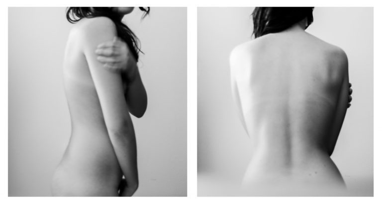 balliamo da sole fotografia terapeutica